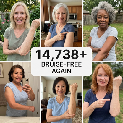 𝘾𝙤𝙧𝙩𝙞𝙭𝙞𝙧® Bruise Repair & Skin-Strengthening Cream